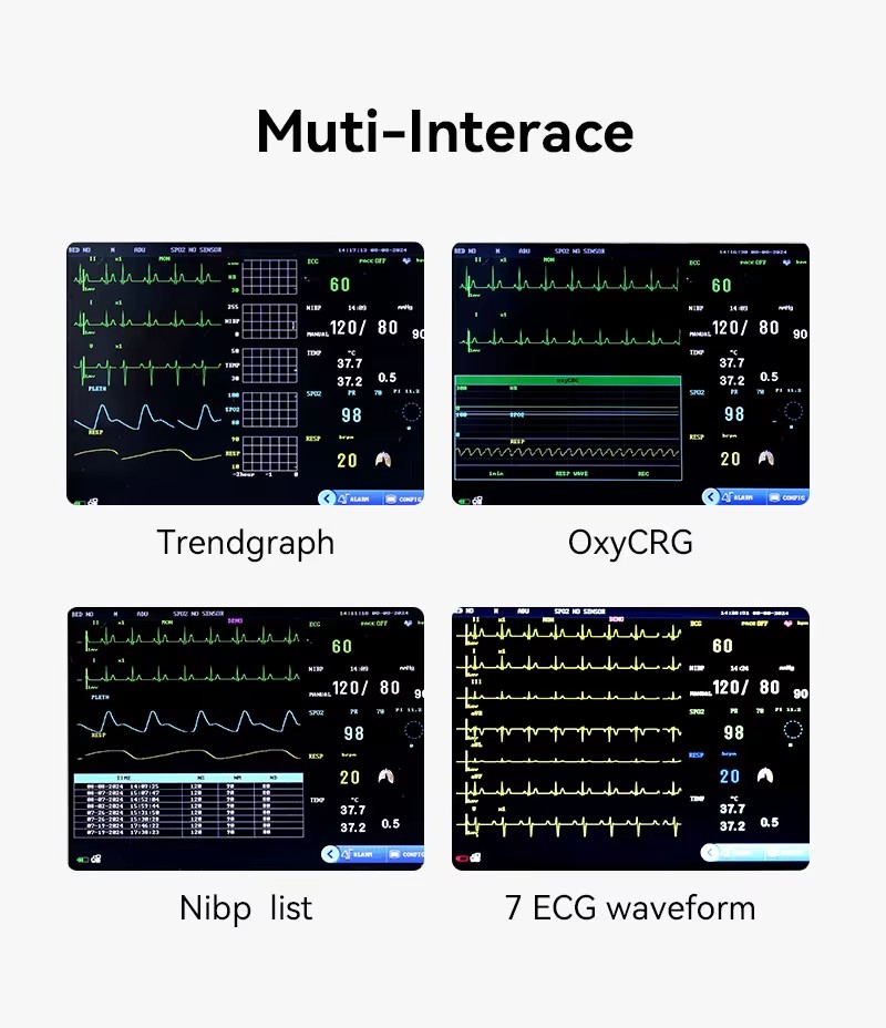 N8 Color TFT Screen Multi Parameter Patient Monitor