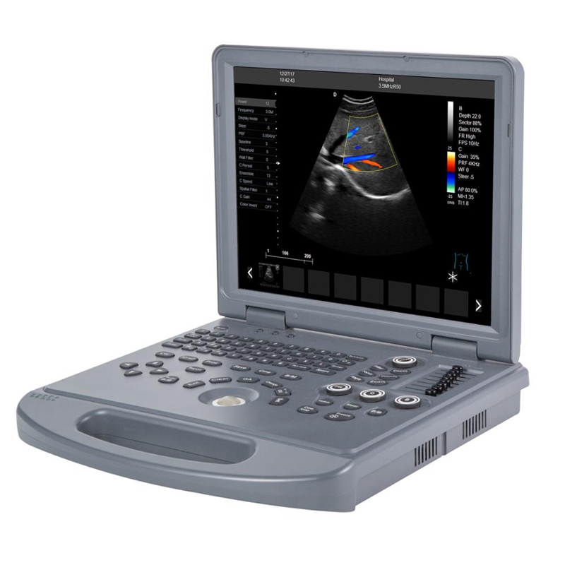 MEK3L Laptop Color Doppler Ultrasound Scanner
