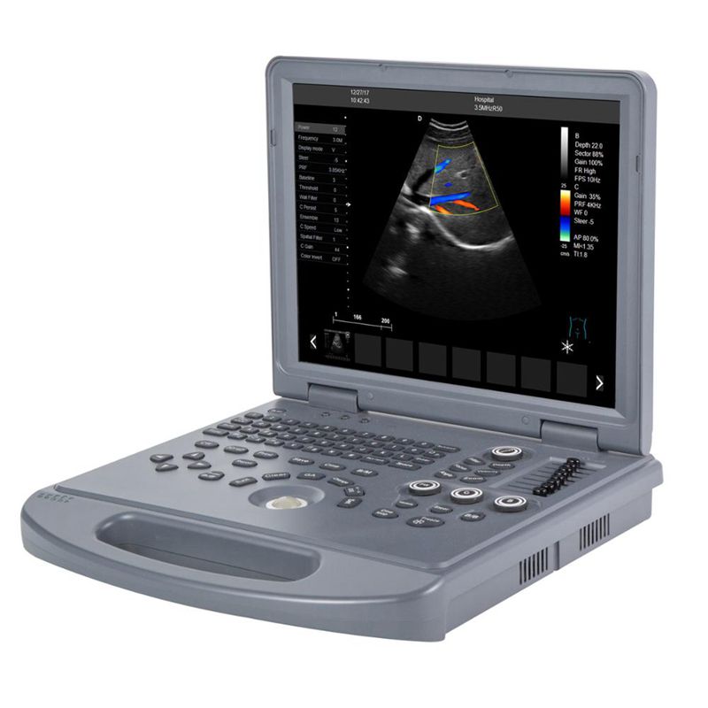 MEK3L Laptop Color Doppler Ultrasound Scanner