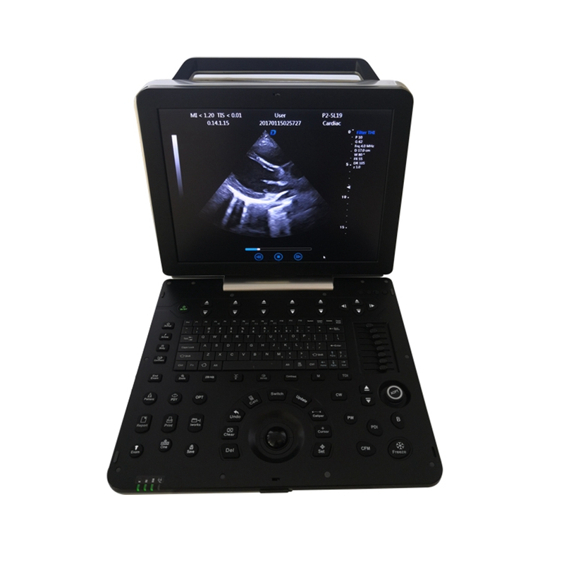 MEK8P Portable Color Doppler 4D Ultrasound scanner