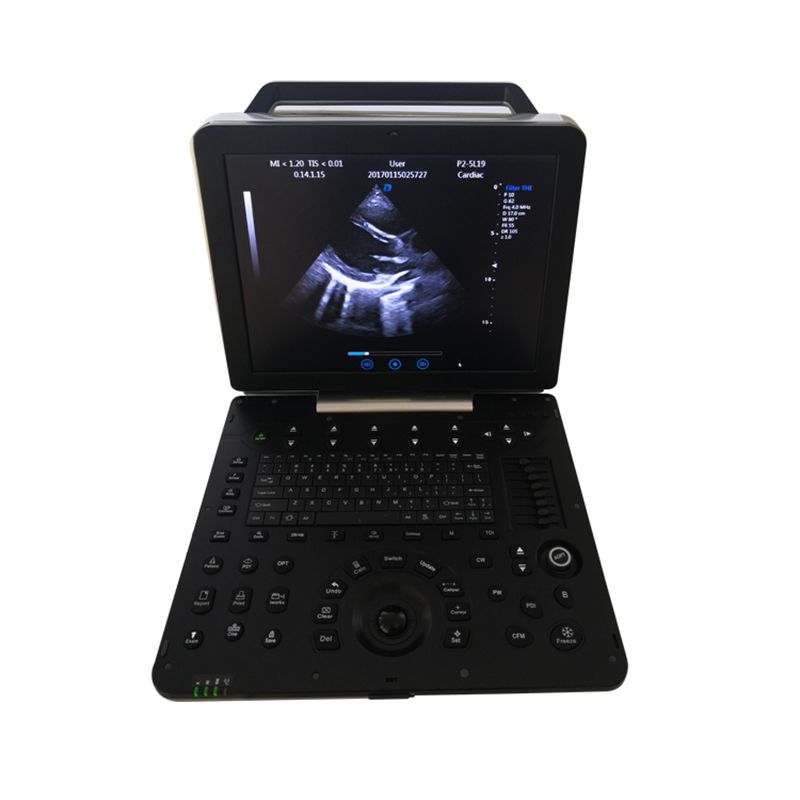MEK8P Portable Color Doppler 4D Ultrasound scanner