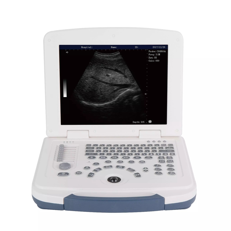 MEK805 Full-Digital B/W Laptop Ultrasound machine