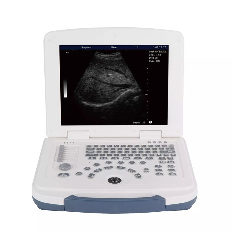 MEK805 Full-Digital B/W Laptop Ultrasound machine
