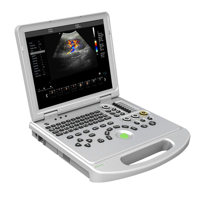 MEK5L Laptop Color Doppler Ultrasound Scanner
