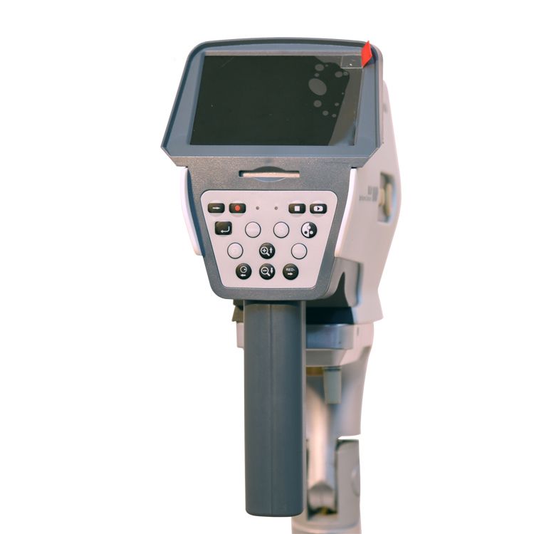 3001 video vaginal endoscopy