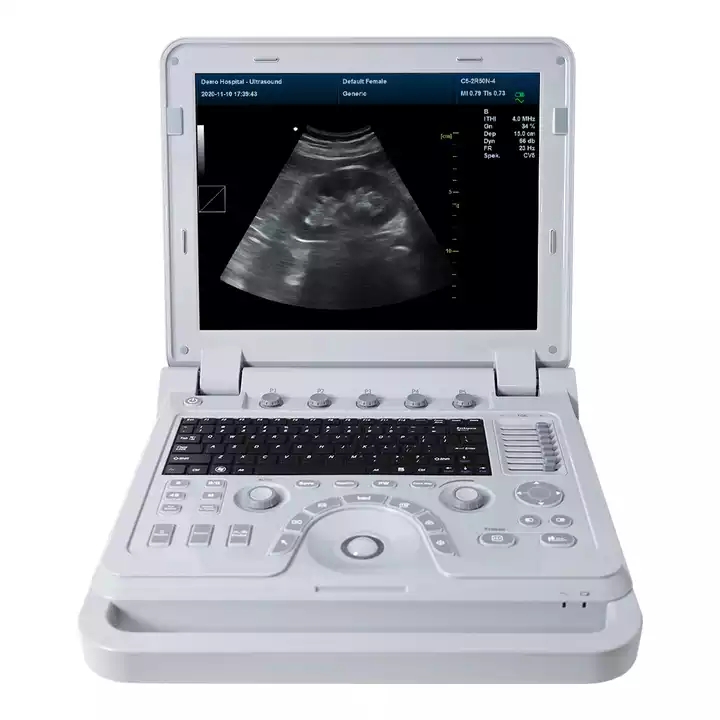 CMS600P2PLUS notebook ultrasound machine
