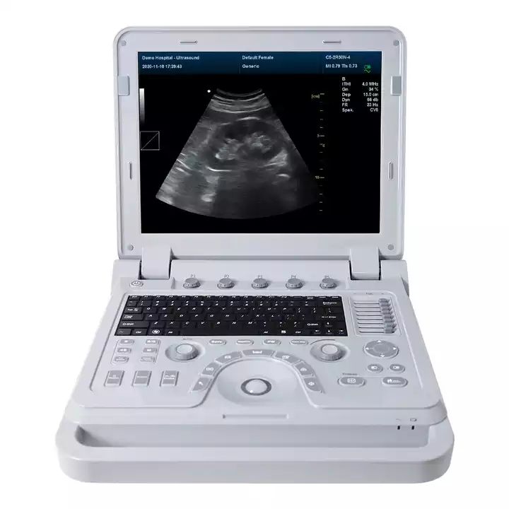 CMS600P2PLUS notebook ultrasound machine