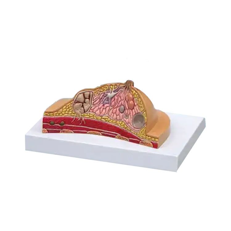 Pathological section model of female breast medical teaching breast model