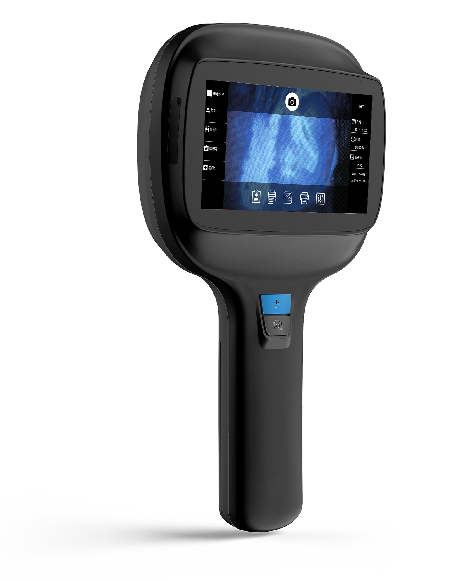 9000A Portable Dermatoscope 365nm skin analyzer uv wood lamp