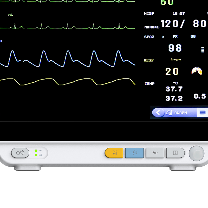 MEK-YK8000D 14 Inch TFT LCD Screen Vital Signs Monitor Advanced Patient Monitor
